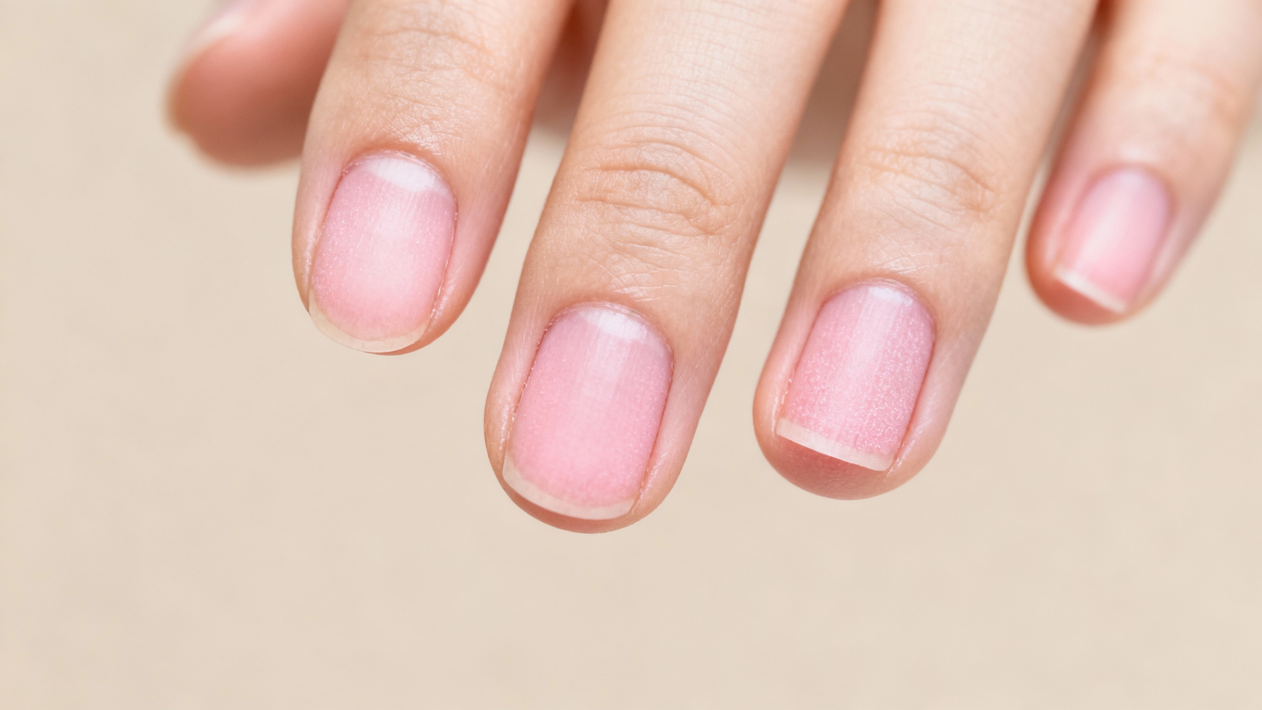 Featured image for Understanding Nail Fungus: Causes, Symptoms, and Prevention
